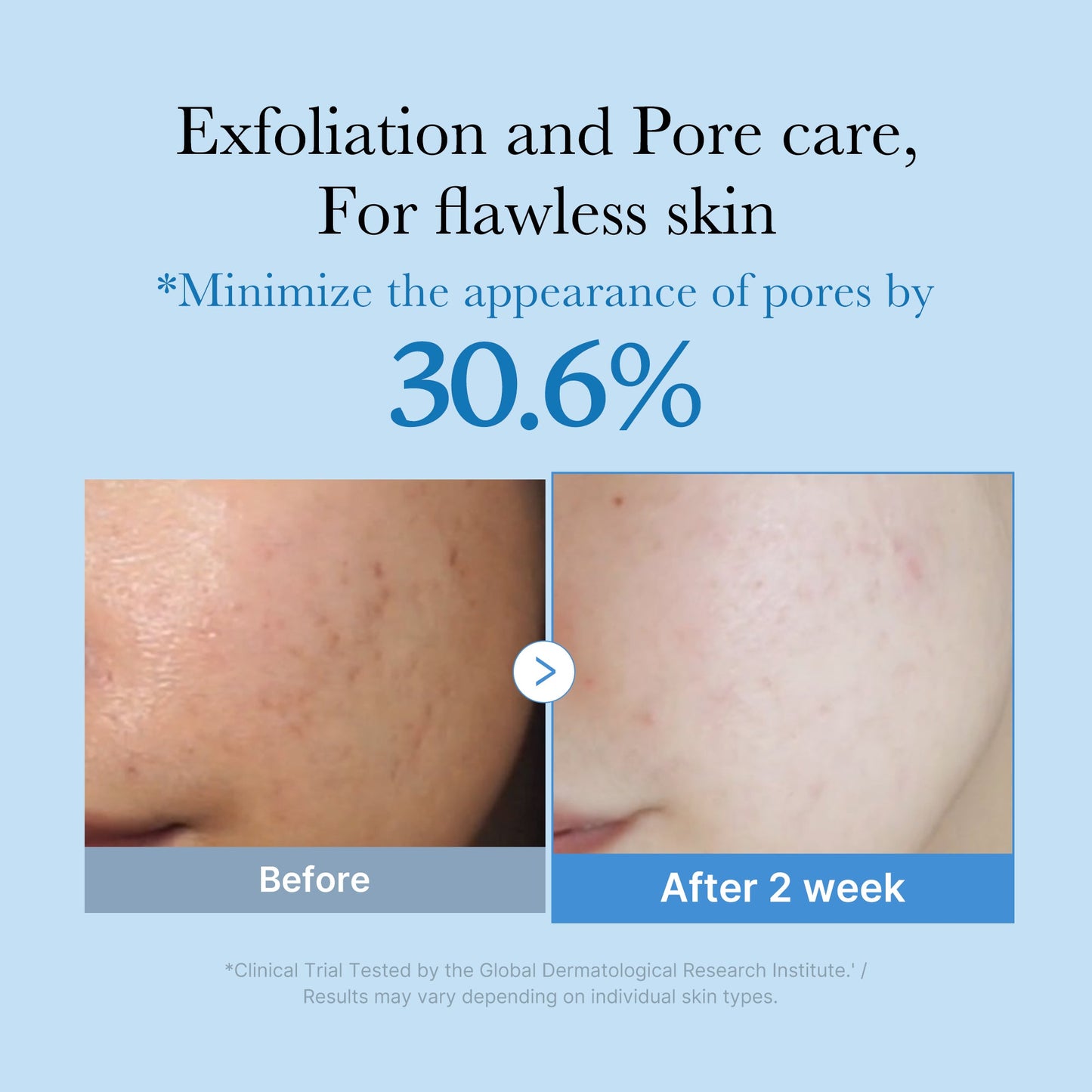 zero-pore-toner-d1 01_d6480b4e-3c08-4954-994a-ed5212c1839c.jpg