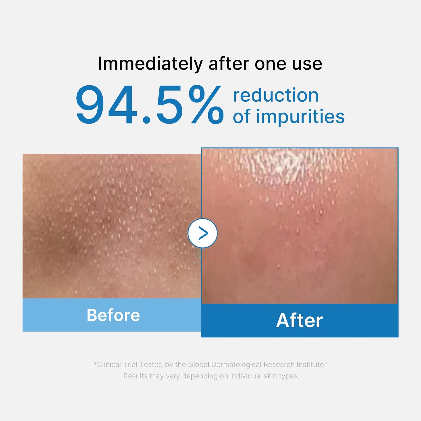 zero-pore-blackhead-deep-cleansing-oil-s0 01_eed557ec-5857-46a2-8b17-dbd67c692dcb.jpg