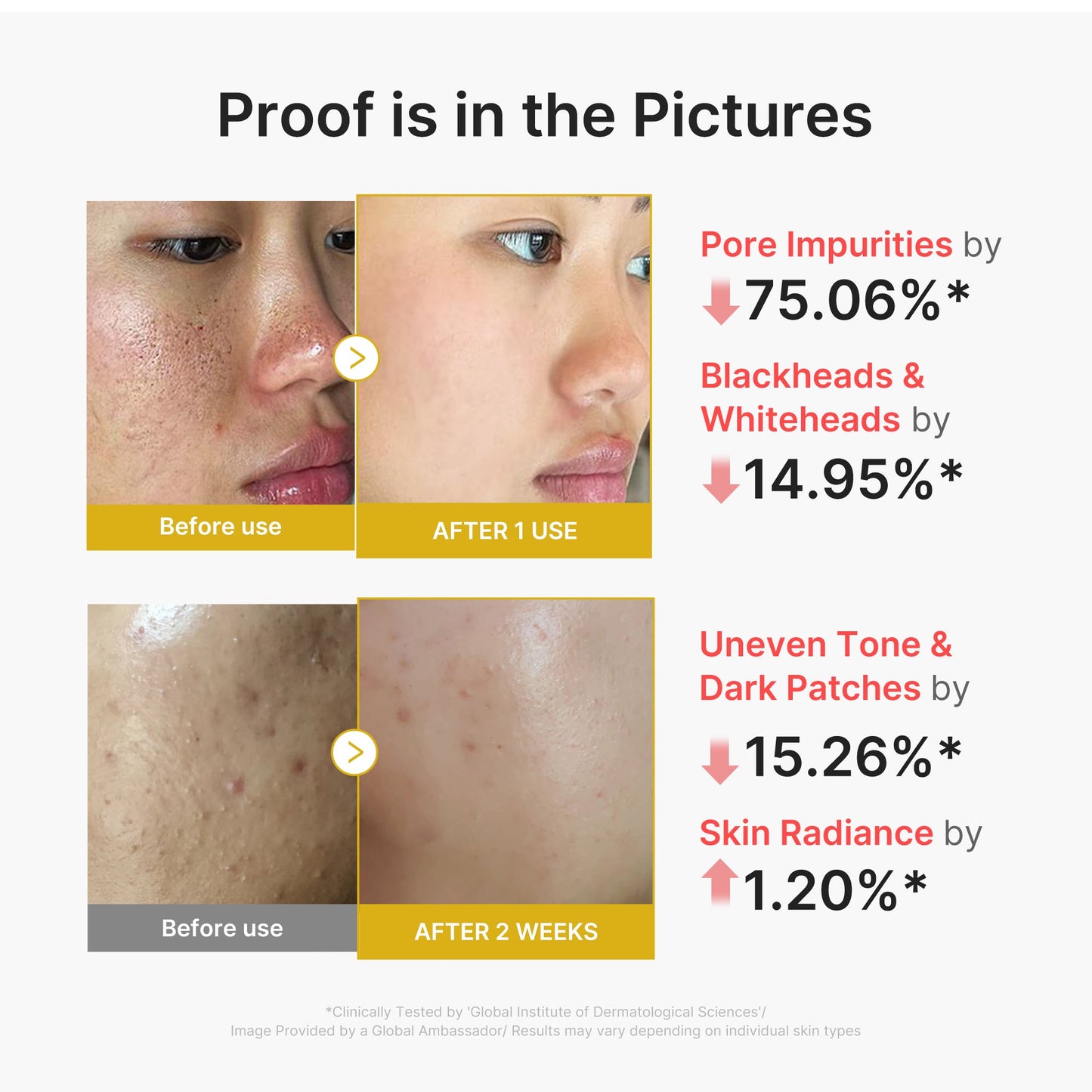 kojic-acid-turmeric-peel-shot-w3 02_45fe66d3-b3f6-4100-aa52-2afd7eded417.jpg