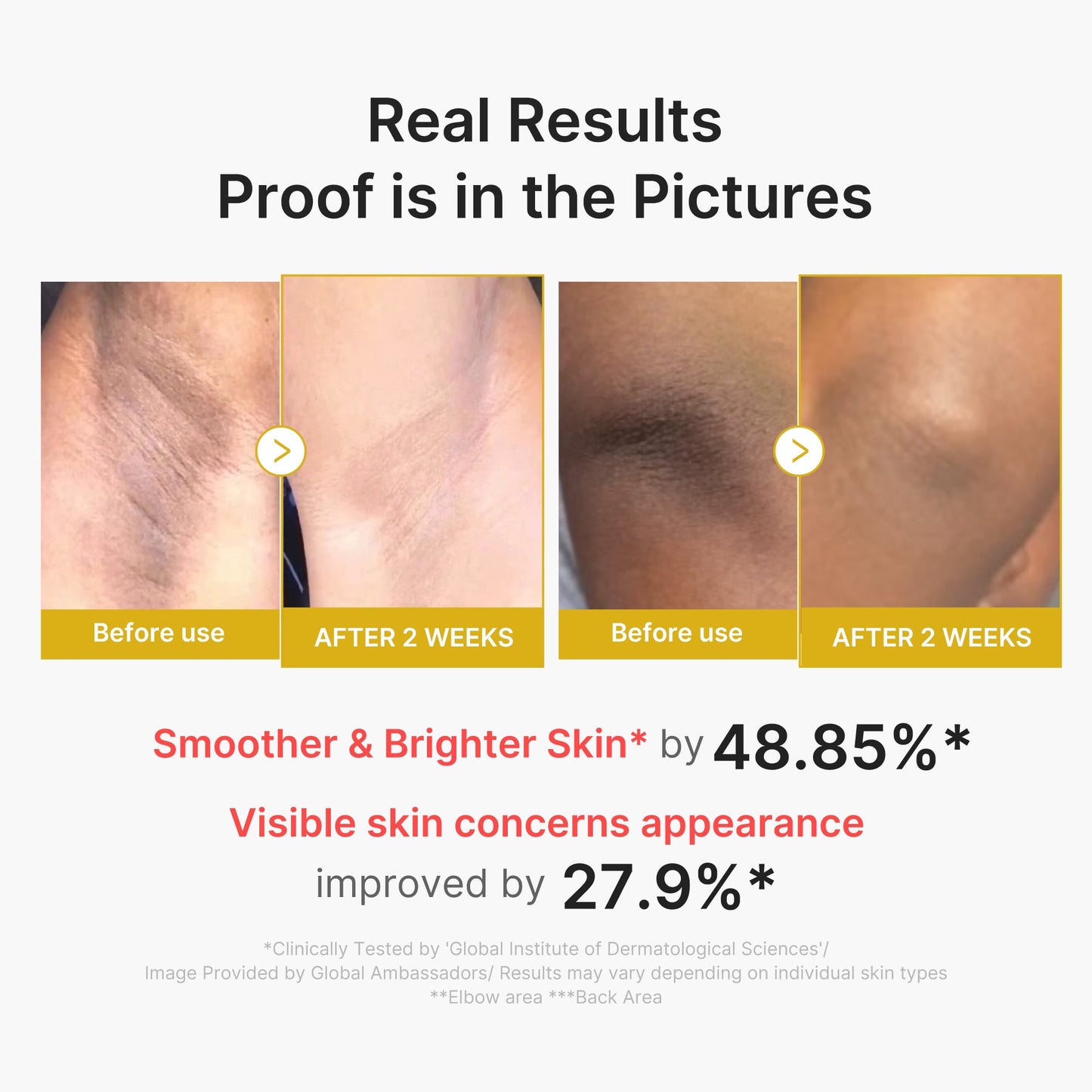 kojic-acid-turmeric-body-peel-shot-u0 02_72880cfc-382b-440b-8152-7e3dce87da2a.jpg
