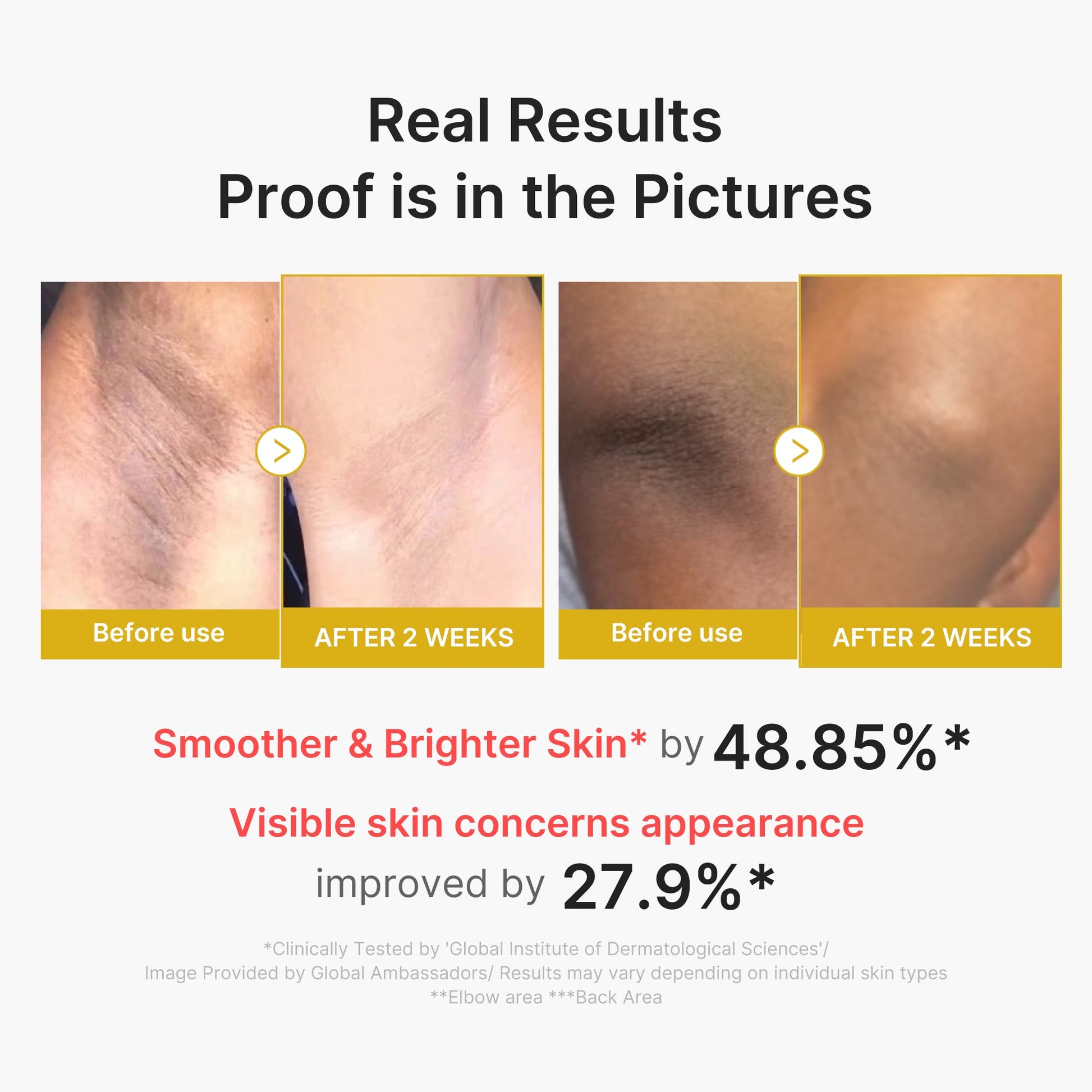 kojic-acid-turmeric-body-peel-shot-u0 02_72880cfc-382b-440b-8152-7e3dce87da2a.jpg