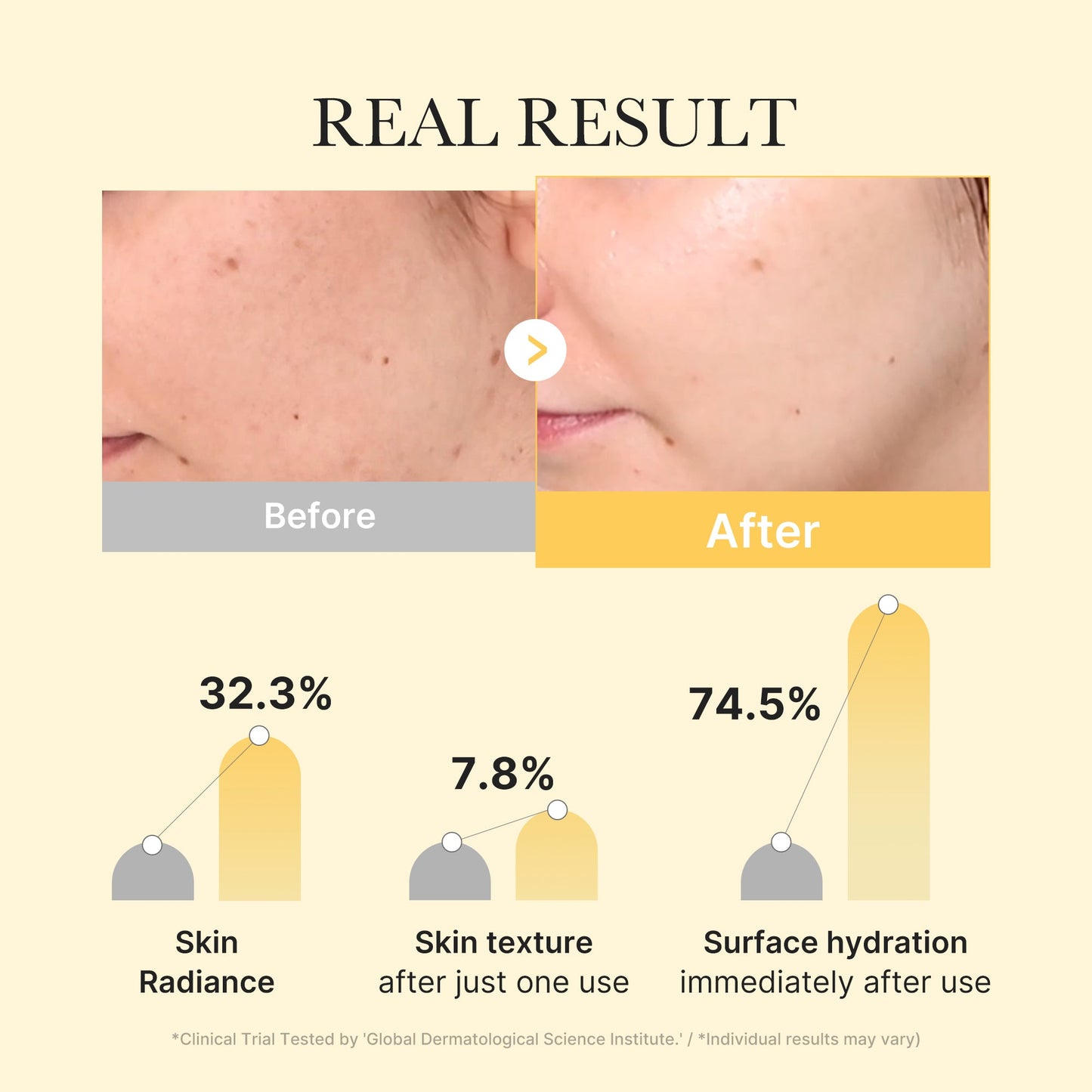 kojic-acid-turmeric-gold-jelly-gel-mask-b4 02_bc3f6017-37f9-4e3c-b32d-f84e8c74138f.jpg
