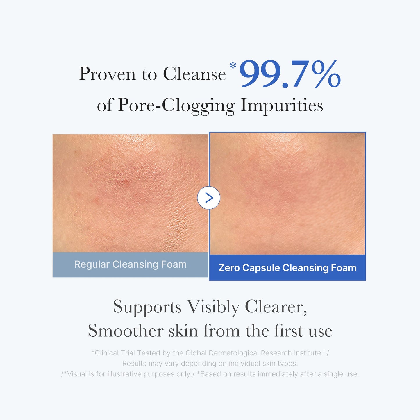 zero-pore-capsule-cleansing-foam-j4 02_c1fb9dfb-86c5-4038-8ff8-490d1006276c.jpg
