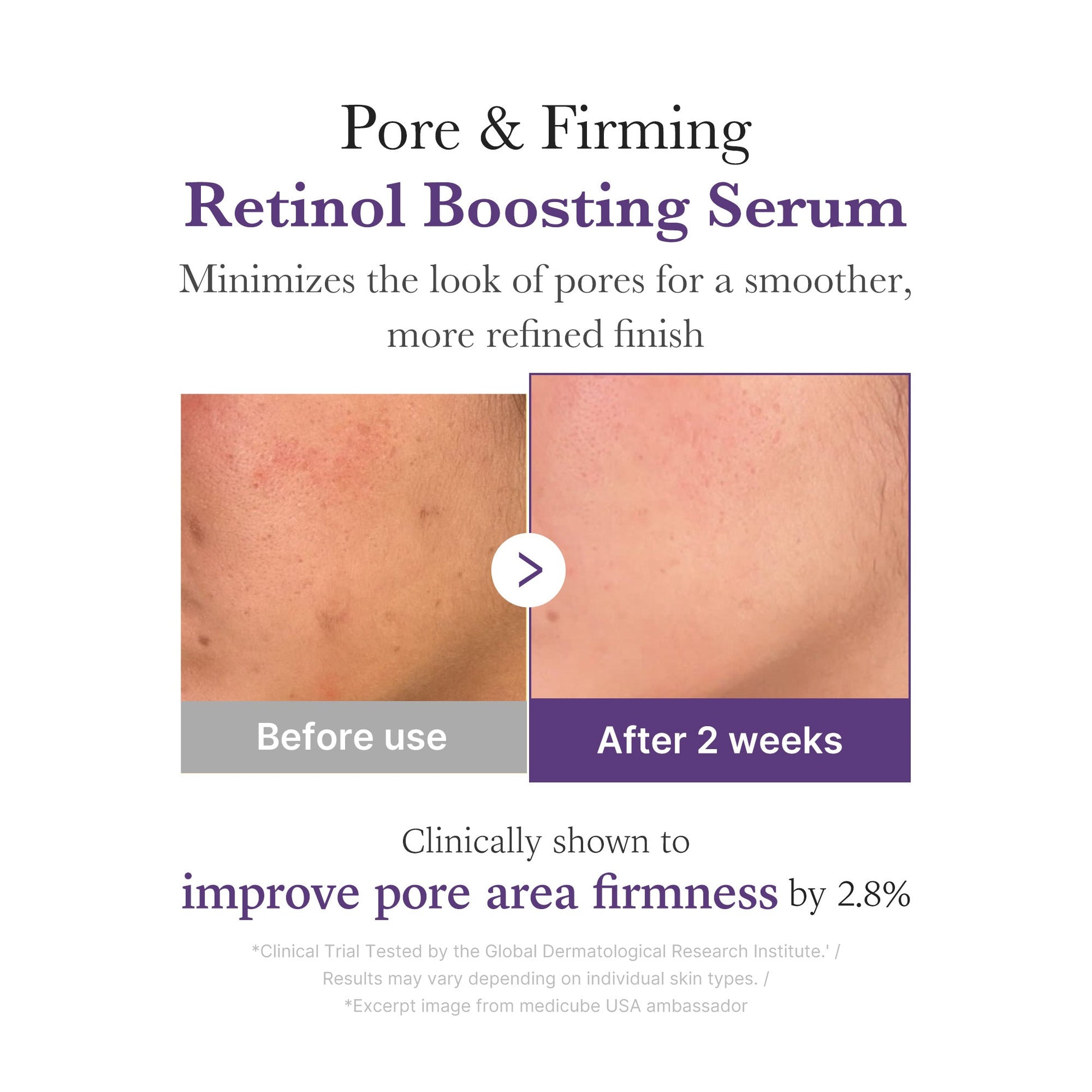 retinol-nmn-boosting-serum-y2 03_3510e7a5-5633-4a18-81ea-1389593bd517.jpg