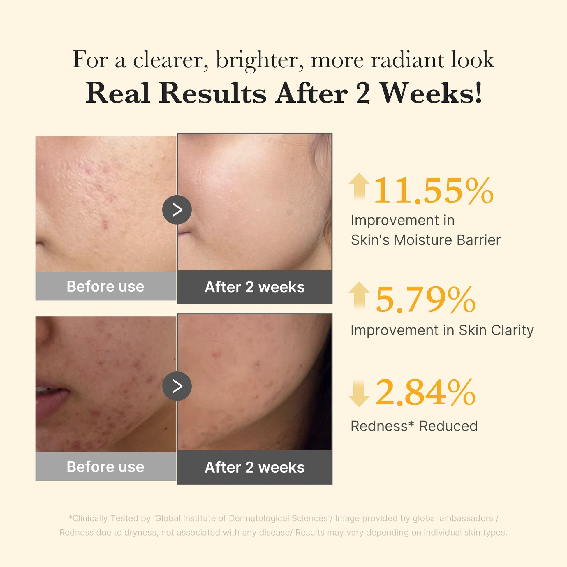 kojic-acid-turmeric-capsule-serum-j8 03_436487f5-76df-490e-8a61-01118373efbd.jpg