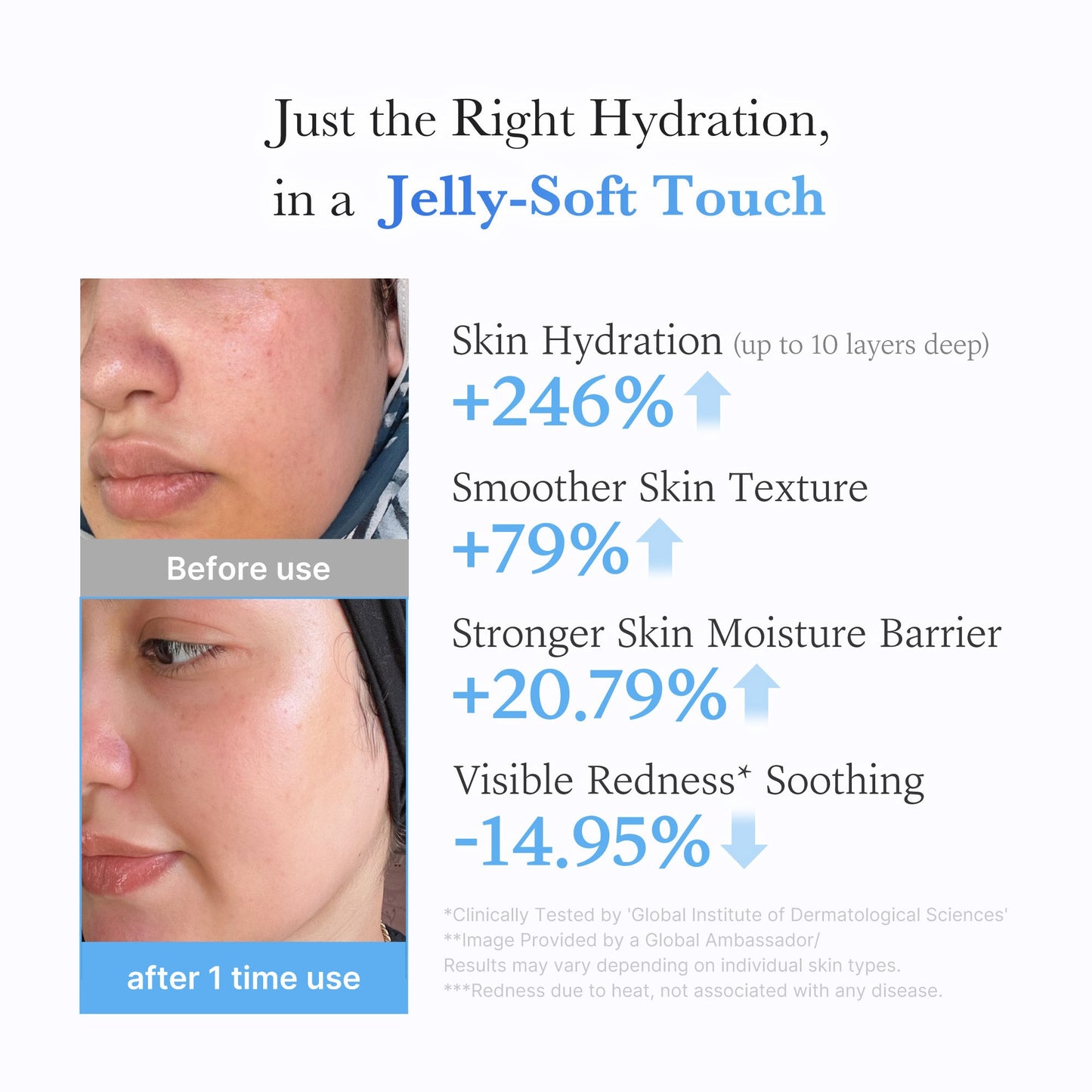 hyaluronic-ceramide-moisturizing-jelly-cream-b9 03_c39d66cc-0839-4e48-ab4a-d32143d06b1c.jpg