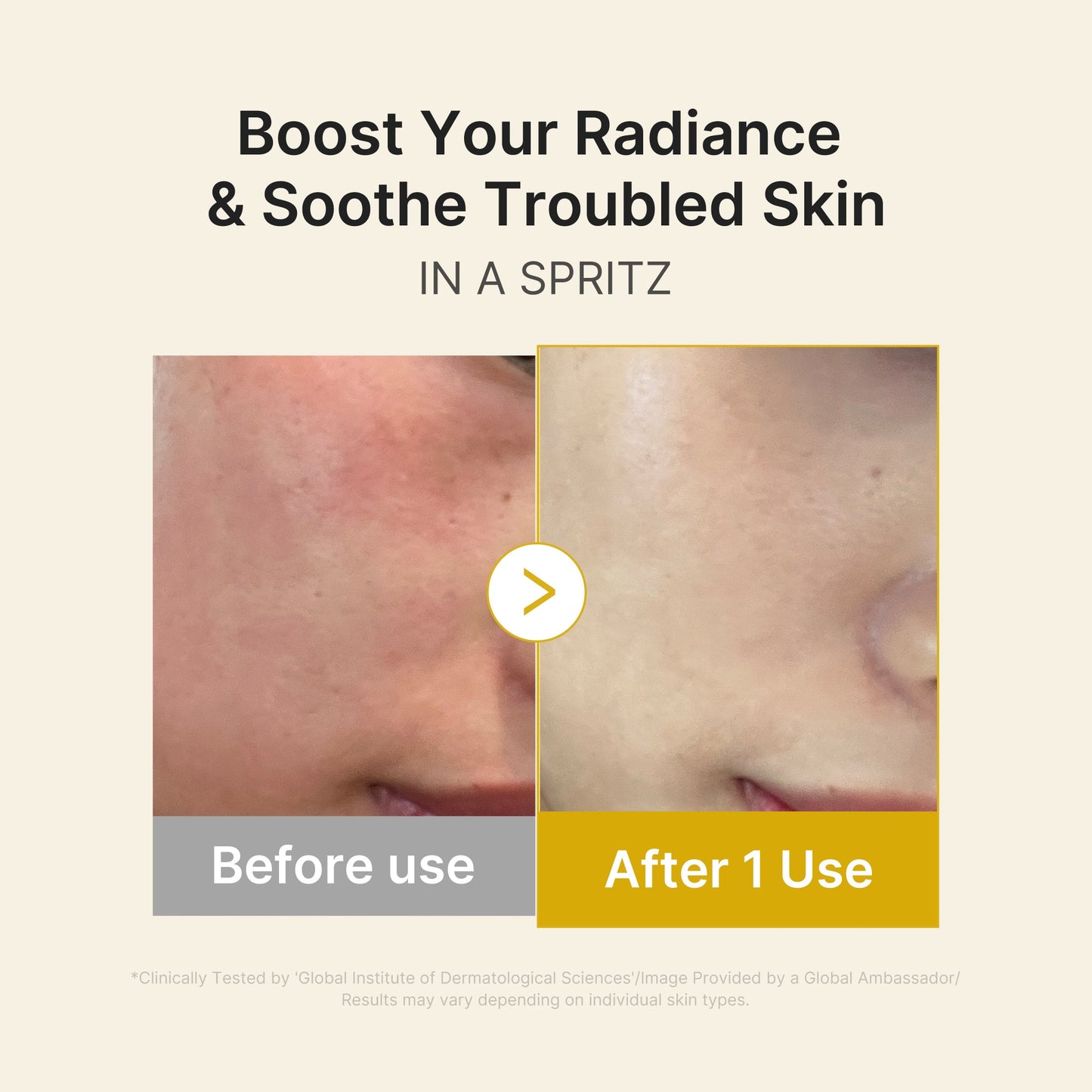 kojic-acid-turmeric-vitamin-gold-jelly-mist-serum-n4 03_dc9cd19e-4e57-49d3-9b66-c7762e8a63f1.jpg