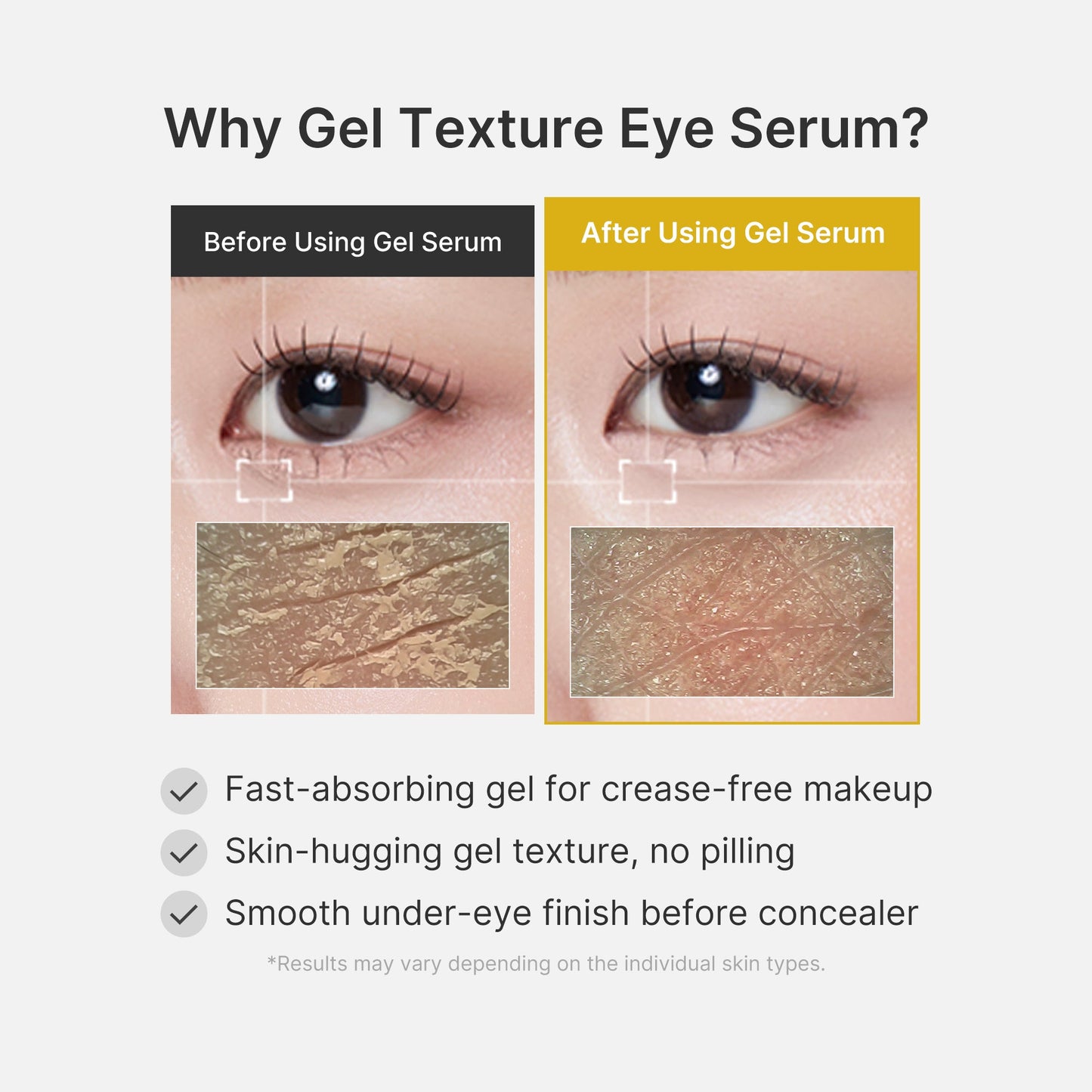 kojic-acid-tumeric-eye-gel-serum-k5 04_0487ef36-49f4-4294-8049-bb55118b05fe.jpg