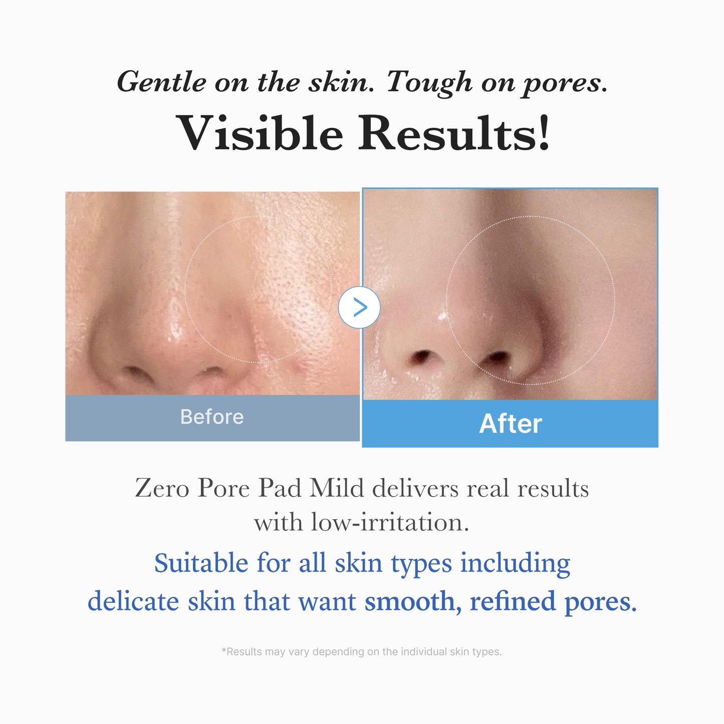 zero-pore-madecassoside-pads-mild-n3 04_6357f9f9-483b-4891-82c6-a58d336e62c8.jpg