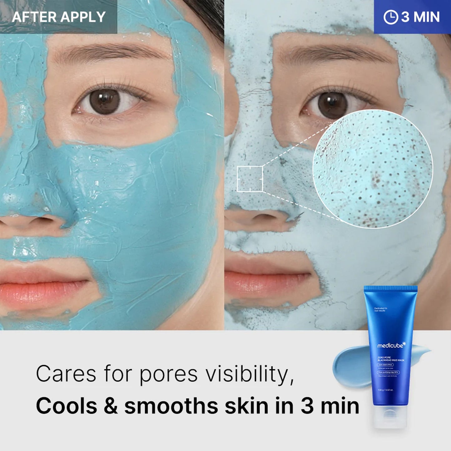 zero-pore-blackhead-mud-mask-z7 04_867c0459-a94e-40d3-bd9a-70400edabe8d.jpg