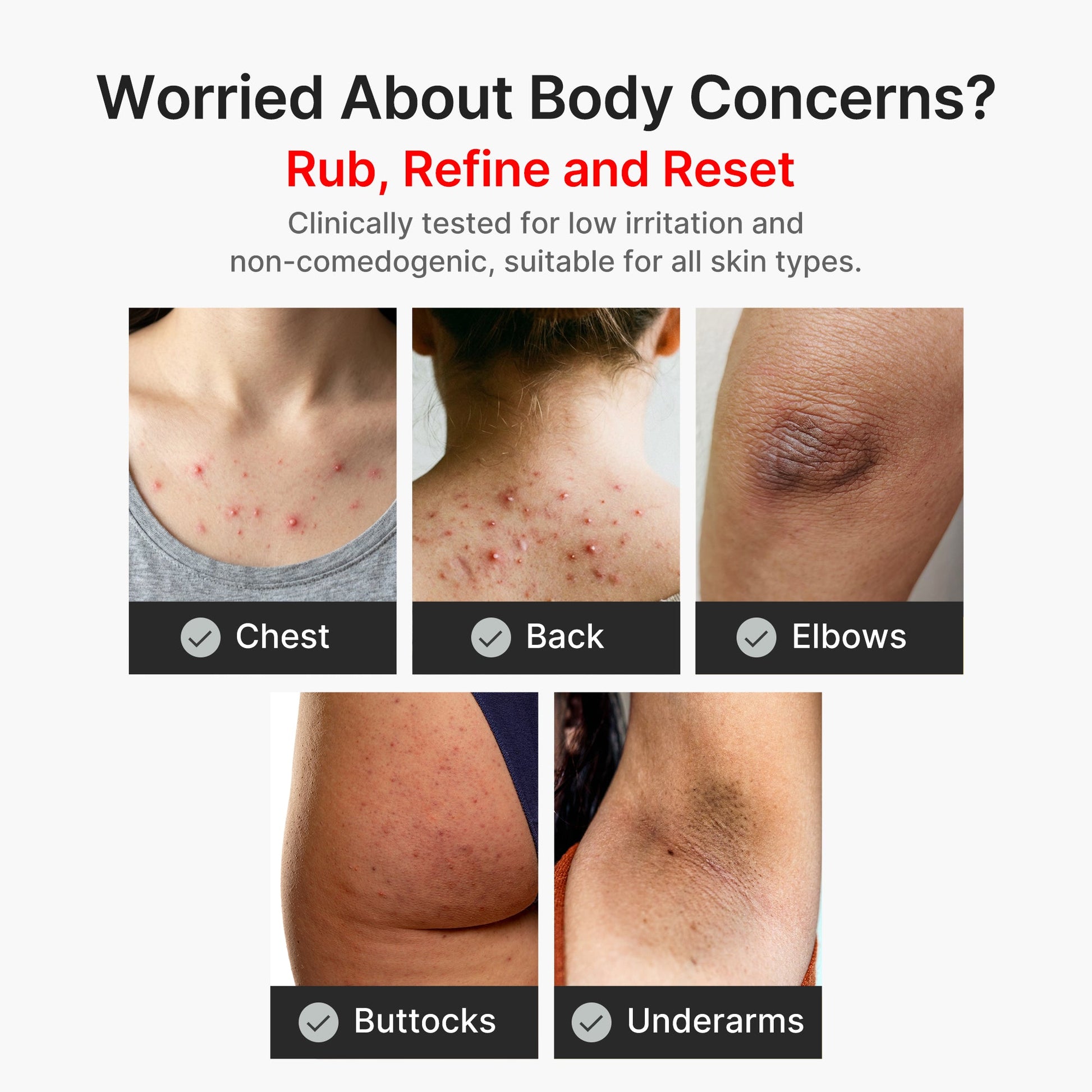 kojic-acid-turmeric-body-peel-shot-u0 04_8a7237f2-3ebf-401e-bd85-54841aeb3efc.jpg