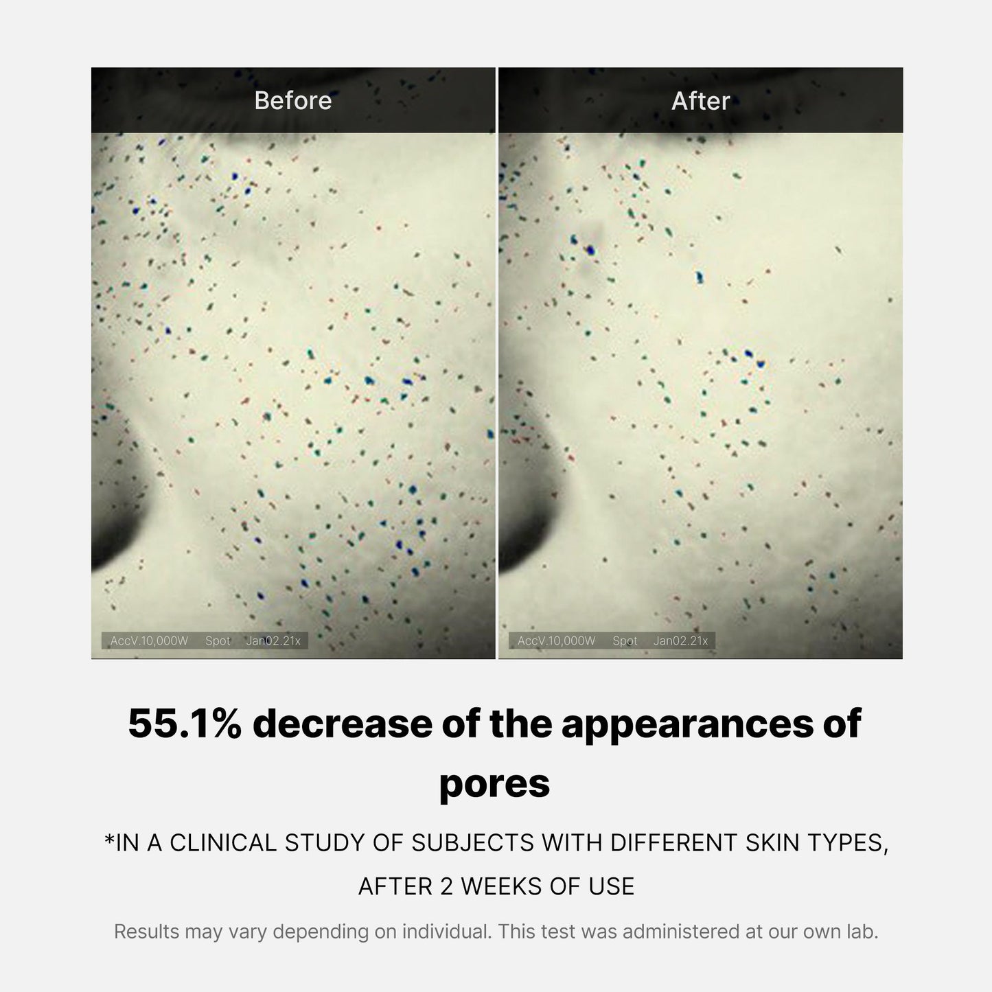 pore-care-duo-b4 05_12ddab8a-64be-4612-8ee1-27e5ec701921.jpg
