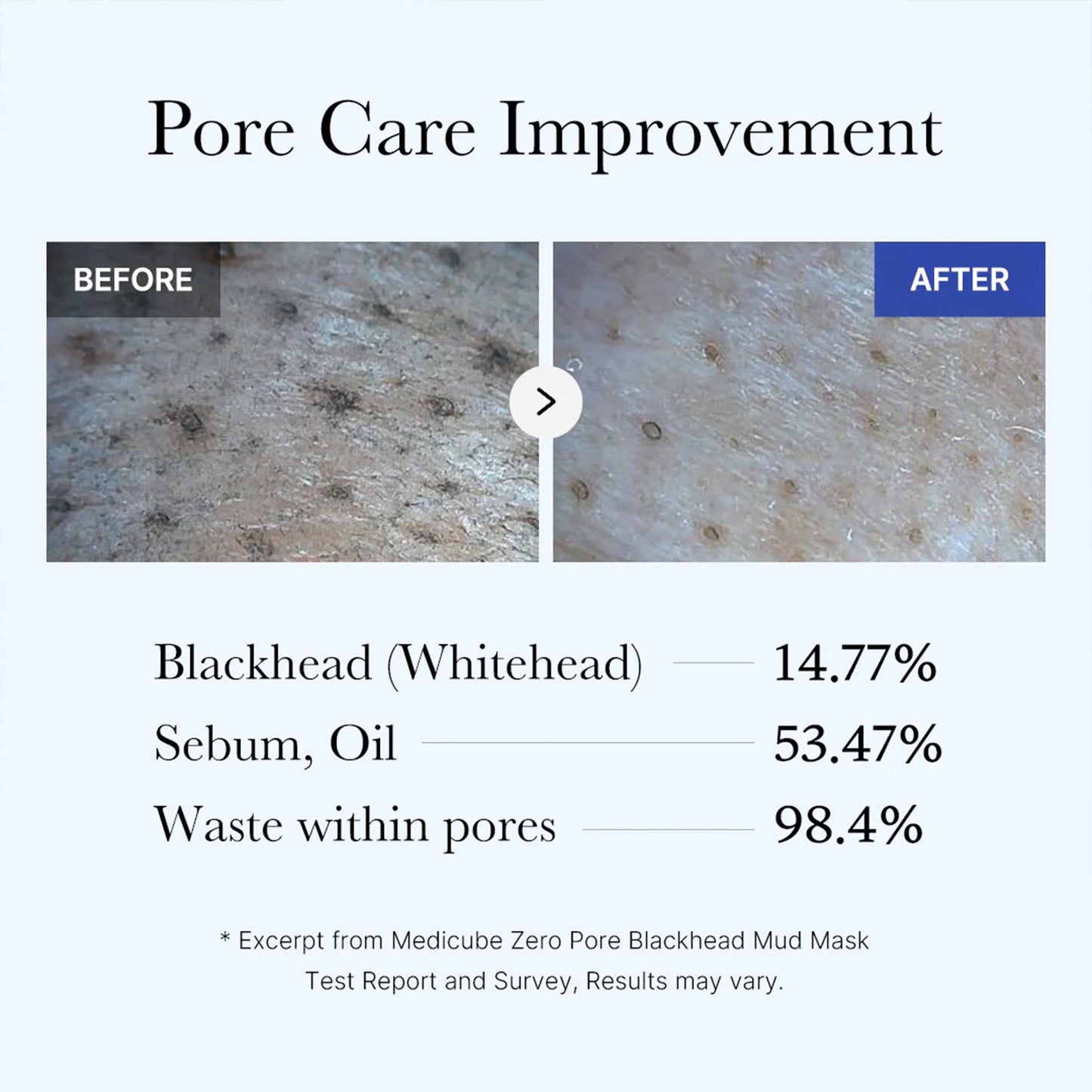zero-pore-blackhead-mud-mask-z7 05_9362a158-c2b3-4525-acc0-631a2cfdea47.jpg