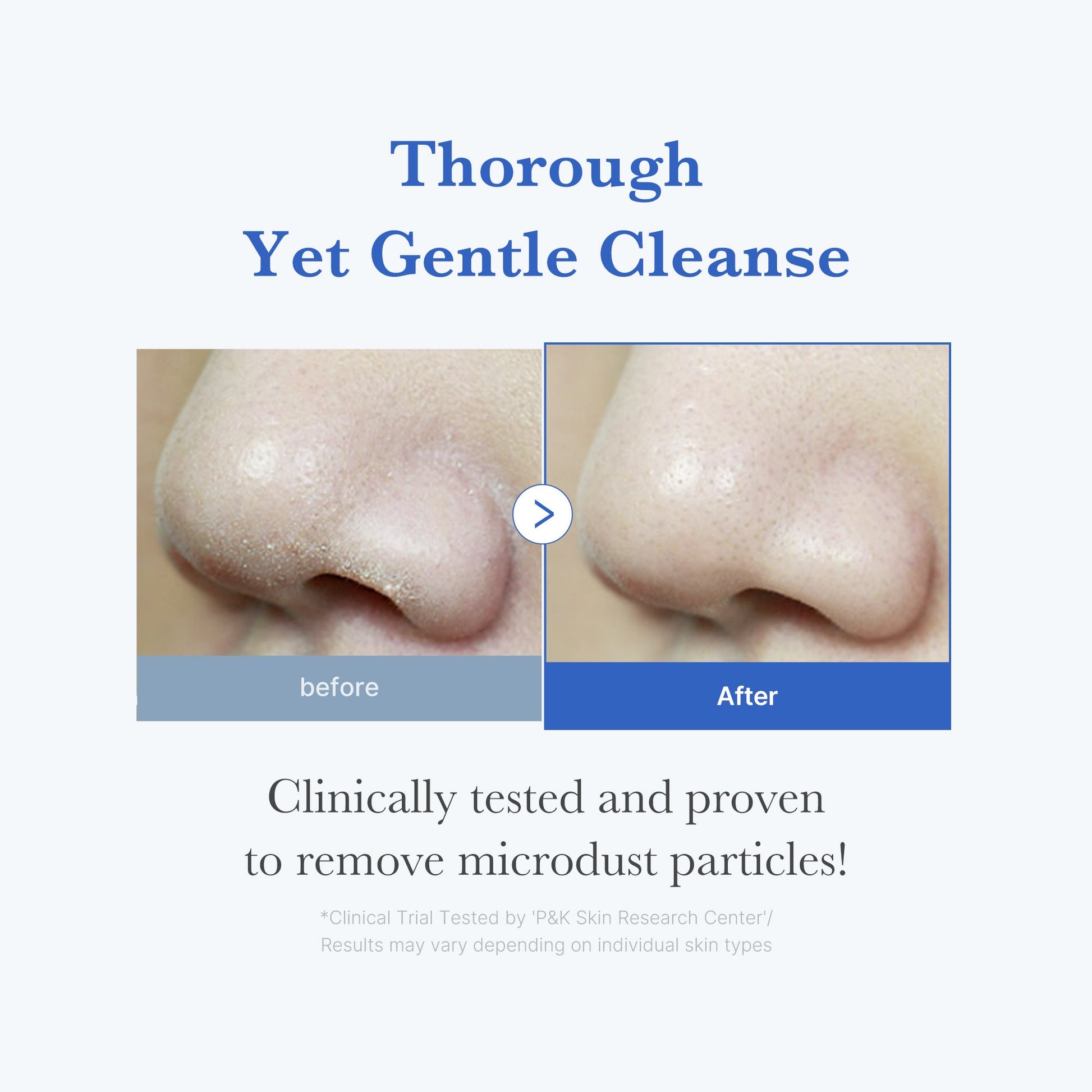 zero-foam-cleanser-w0 250702_ZeroCleanser3.jpg