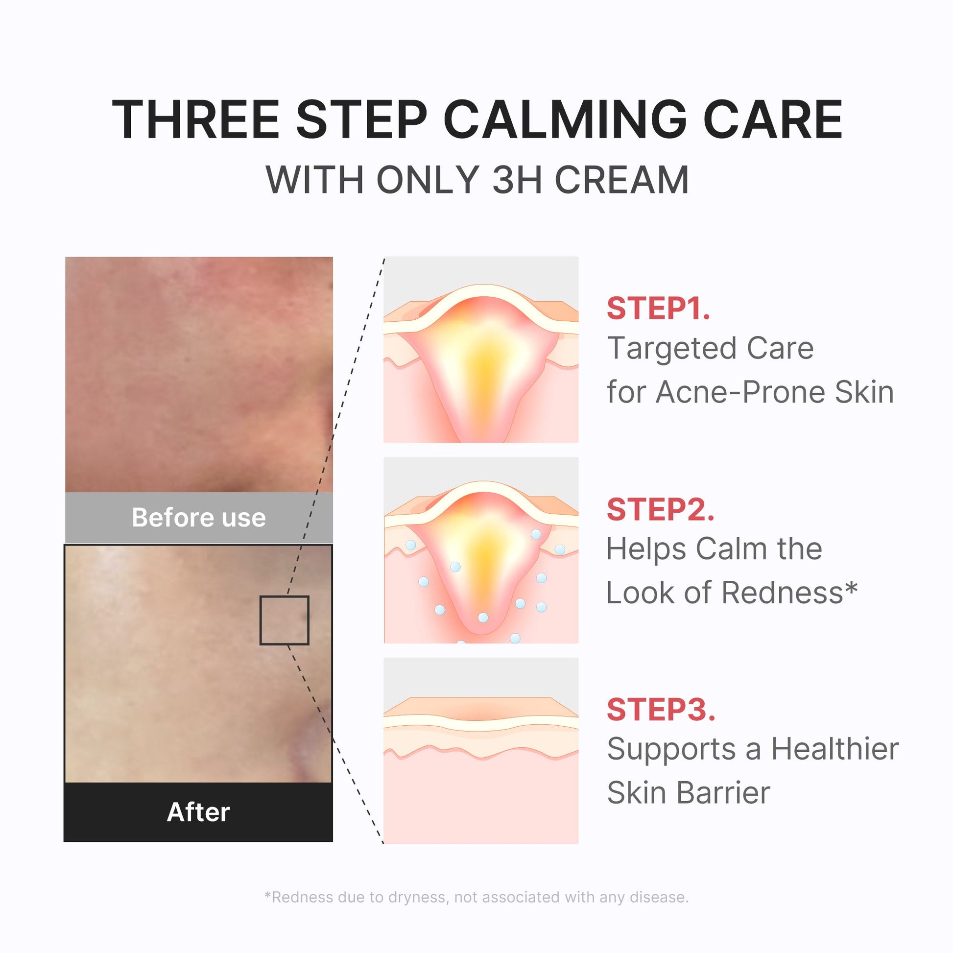 3h-daily-relief-cream-r9 3H_04.jpg