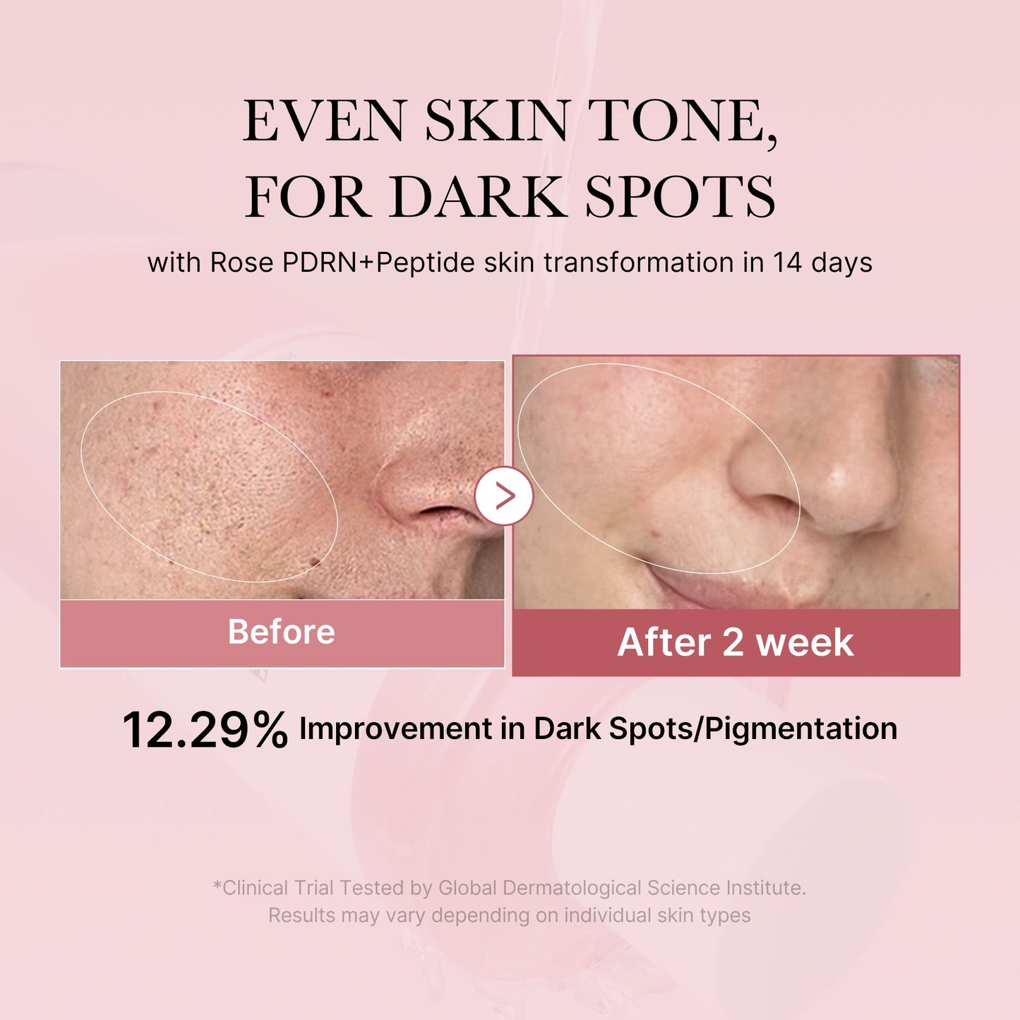 pdrn-pink-peptide-toner-k7 PDRN_01_308c518e-5ac6-4e54-99bd-eabc8796739b.jpg