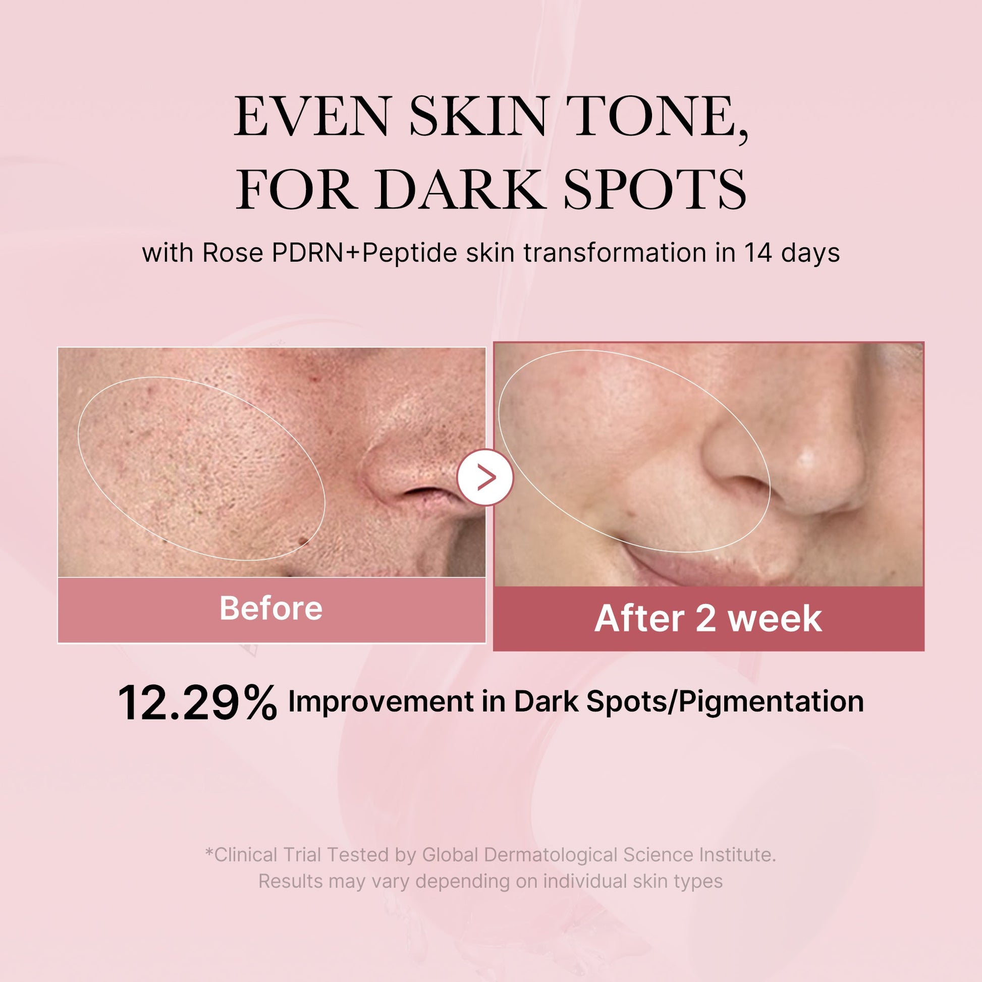 pdrn-pink-peptide-toner-k7 PDRN_01_308c518e-5ac6-4e54-99bd-eabc8796739b.jpg