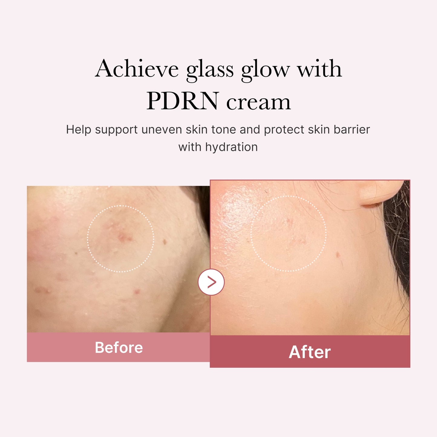 pdrn-pink-peptide-cream-u5 PDRN_02_d7805bfe-cf43-446a-b71b-a276683f136b.jpg