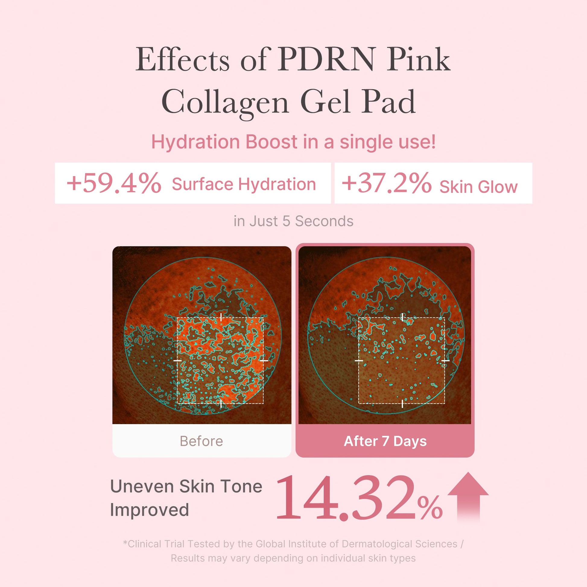 pdrn-pink-collagen-gel-toner-pad-k9 PDRN_04_f9a16a56-8d9e-4c47-a635-ed34ec3ed571.jpg