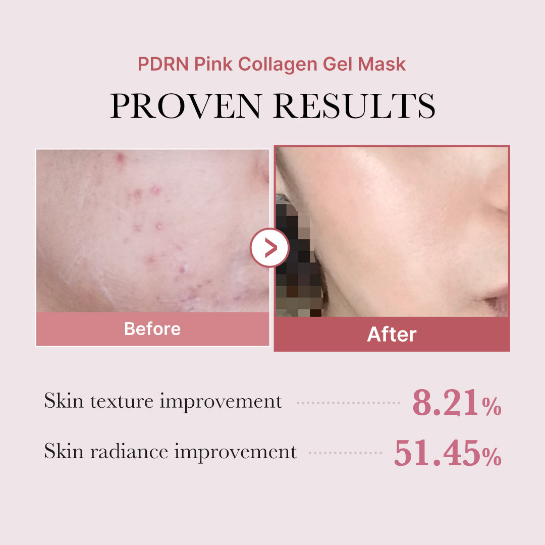 salmon-pdrn-pink-collagen-jelly-gel-mask-i8 PDRN_12.jpg