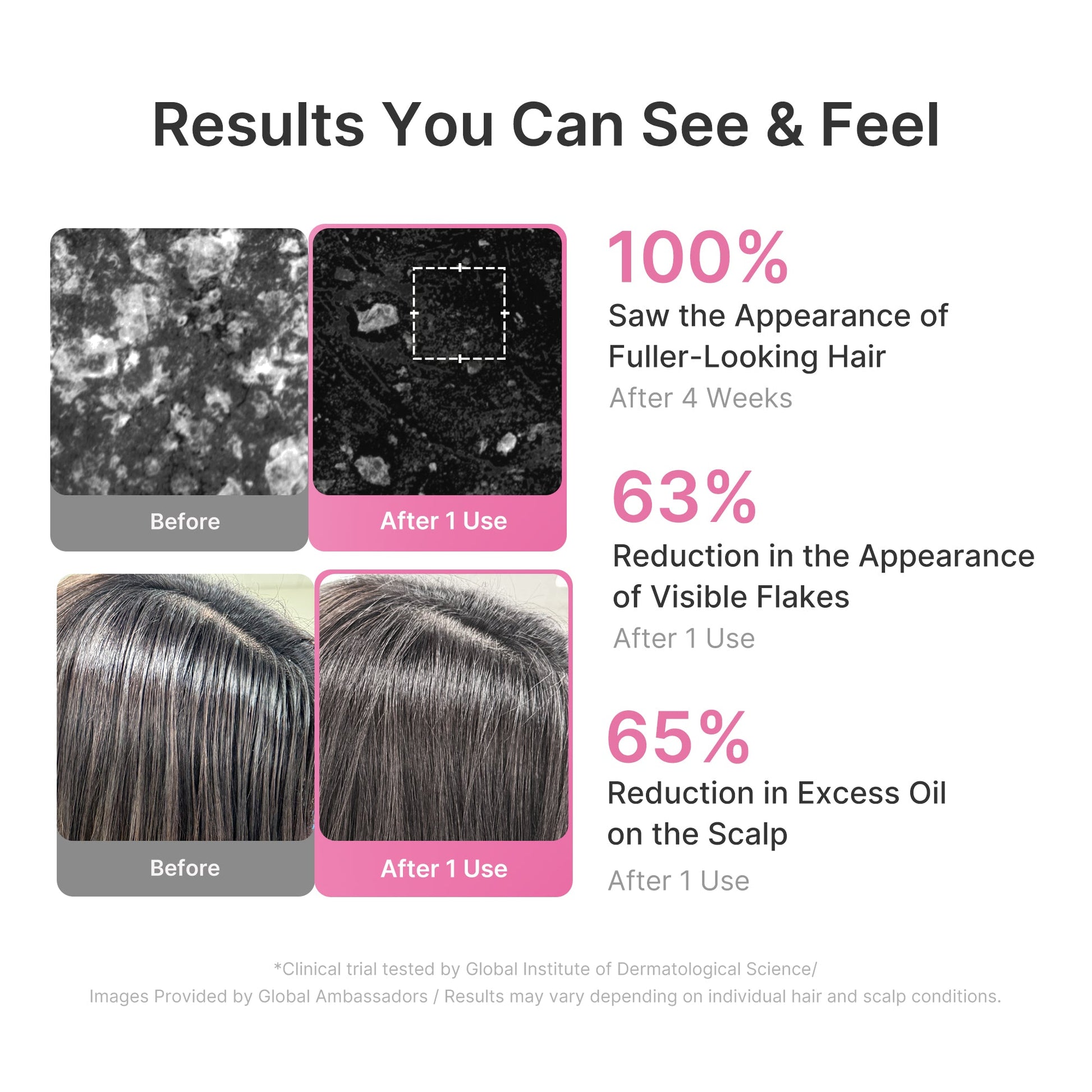rosemary-pdrn-cooling-thickening-shampoo-y9 US_ME_RosemaryShampoo_th04.jpg